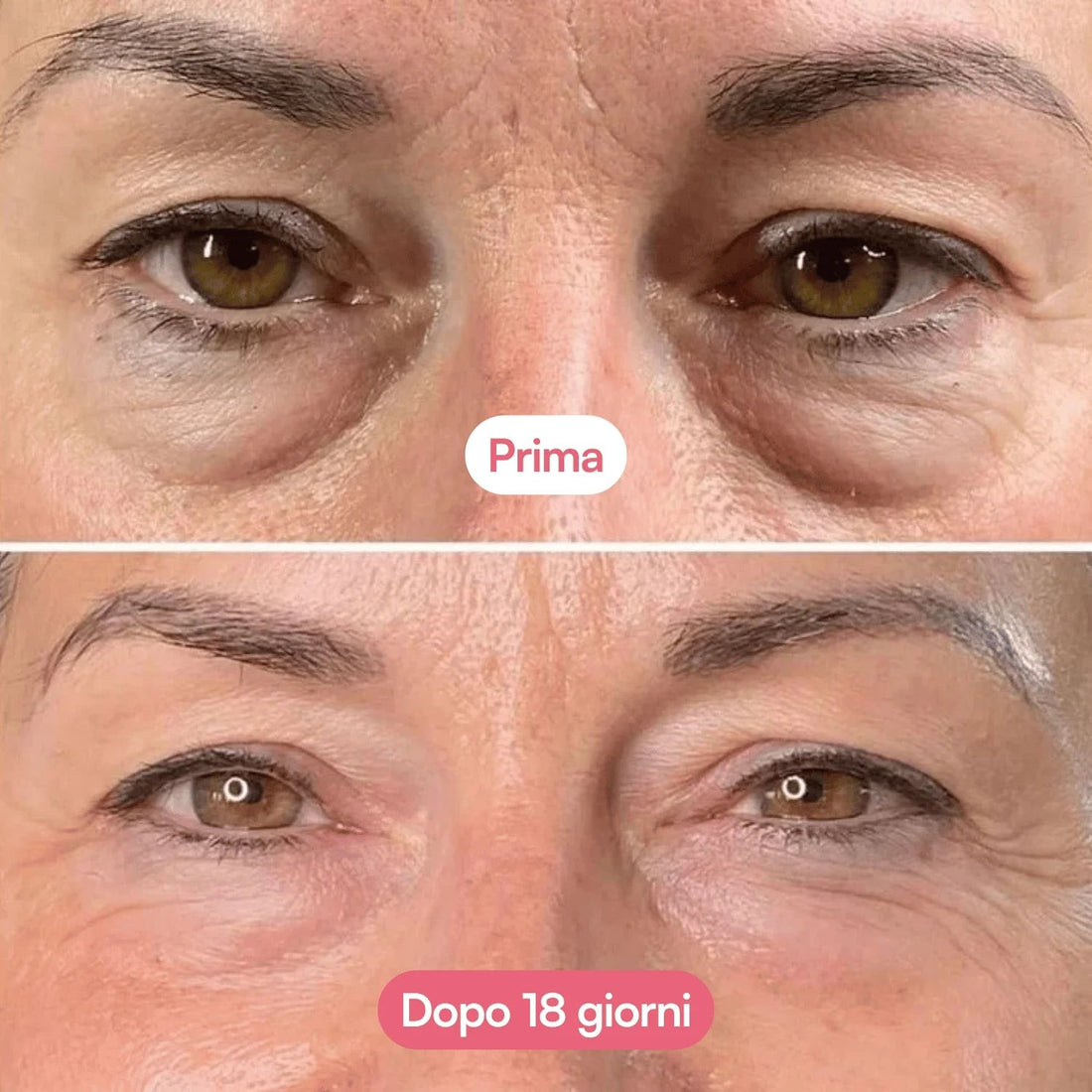 Prima e dopo 18 giorni