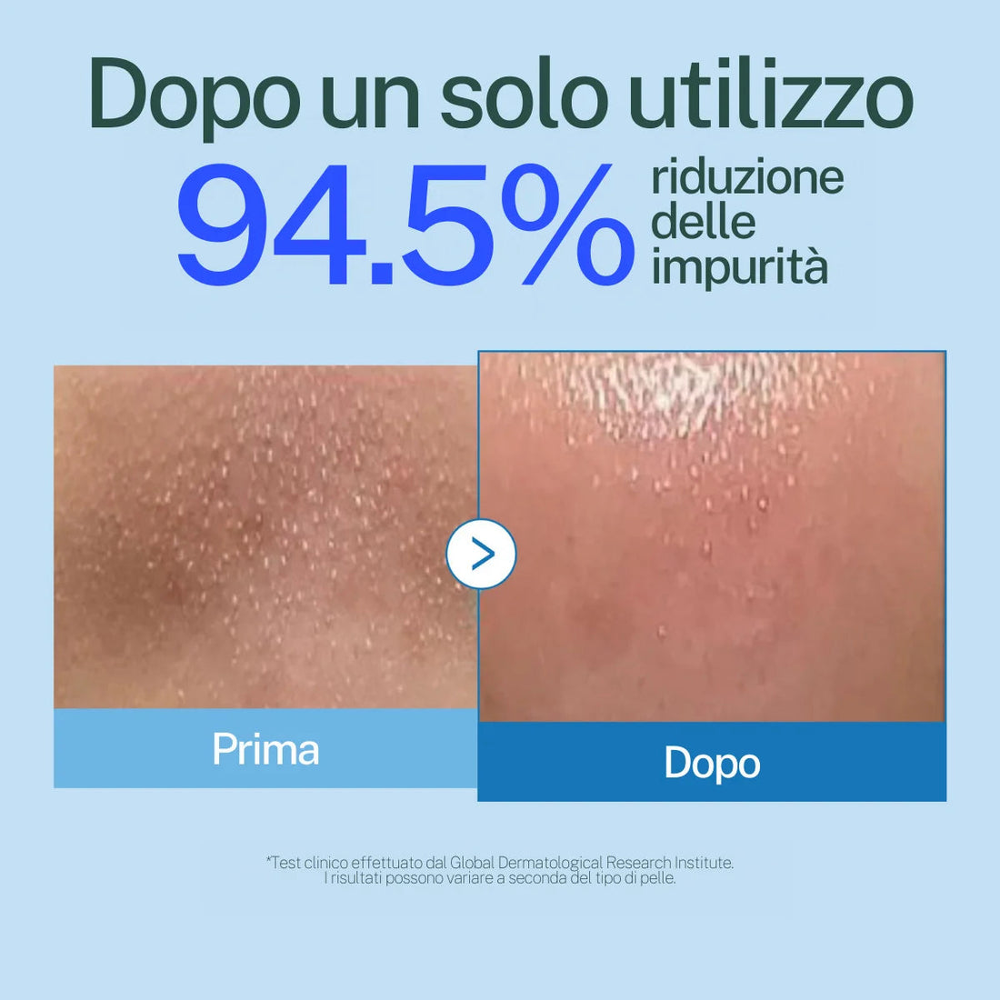 Riduzione delle impurità del 94,5% dopo un solo utilizzo, prima e dopo