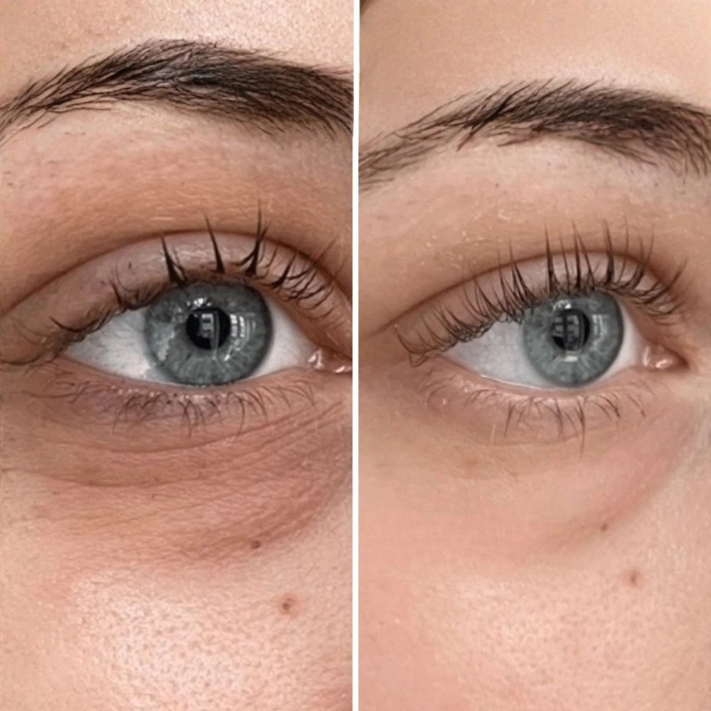 Prima e dopo