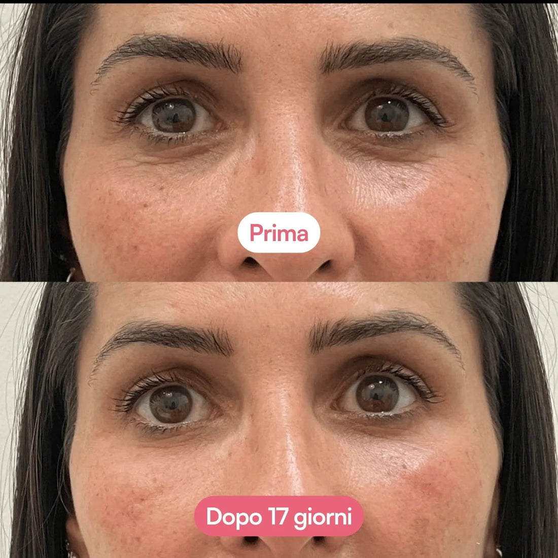Prima e dopo 17 giorni