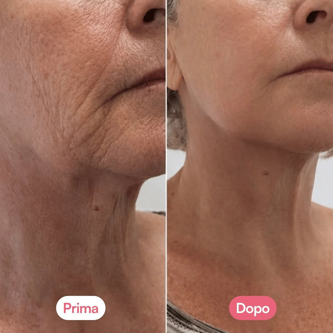 Prima e dopo sul collo