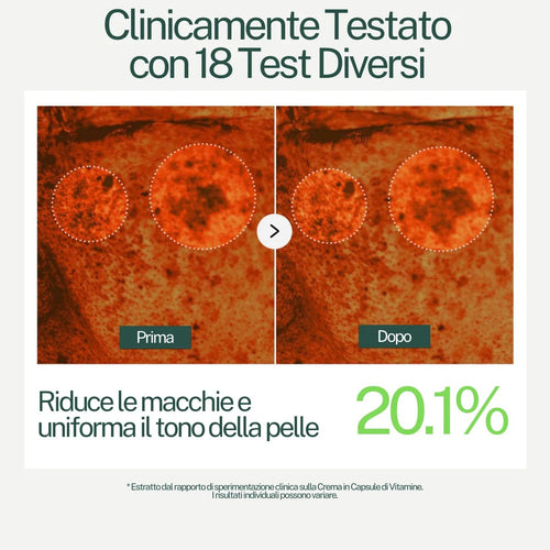 Clinicamente testata: macchie ridotte del 20,1%